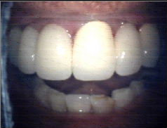 After Treatment