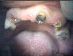 Before Treatment