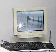 Digital X-rays!
